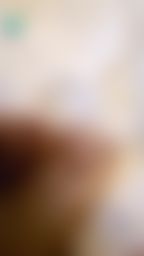 minicat : 昨天撞到門檻,超痛!!!完全沒辦法動,剛仔細看踋淤青到後面去了😭😭😭
完蛋了我今天的業績😭可以私訊説一句【早日康復】嗎?或是幫我多解影片😢講故事的也是分享有趣的故事!!!拜託大家了😢😢😢