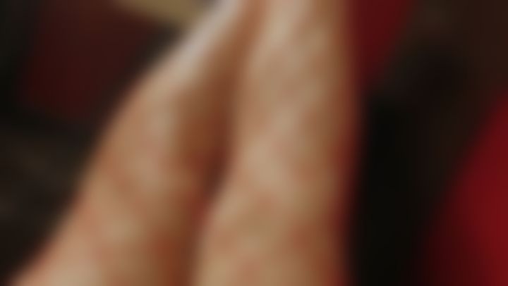 i**********t : my legs