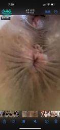 : Butthole shrinks