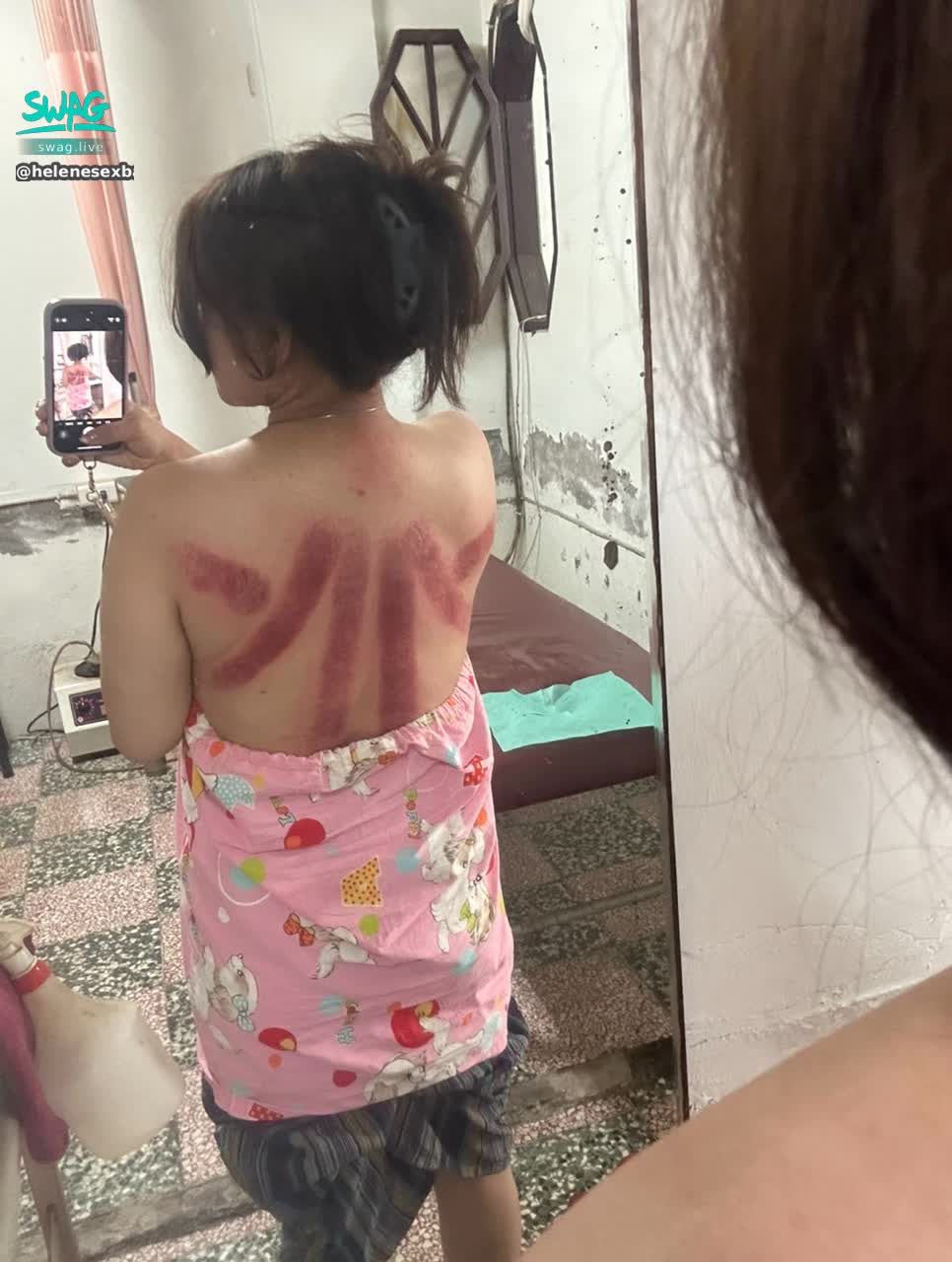 helenesexbaby : 這個背好多朋友都以為我被揍了
不是啊啊～～就是滑罐濕氣很重😓
